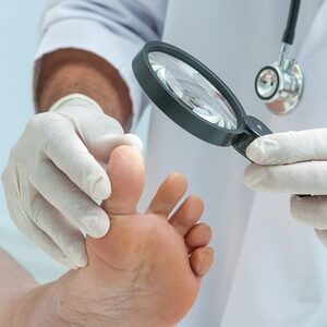 how likely are you to get toenail fungus in Brooklyn, NY?