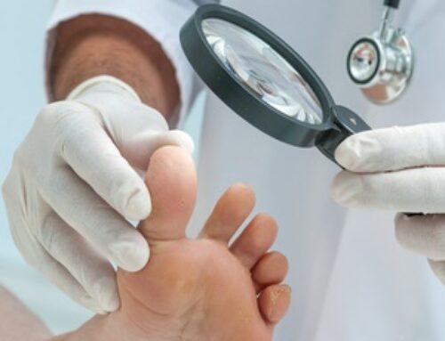 Brooklyn local? How likely are you to get toenail fungus?