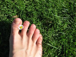 Laser Nail Therapy wants to put your mind at ease. Our doctors are ready to treat your fungal toenails in San Diego, CA.