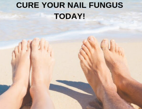 Laser Treatment for Toenail Fungus  in San Jose, CA