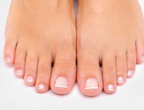 Laser Toenail Fungus Treatment in Houston