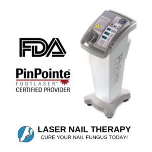 Laser treatment for nail fungus