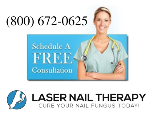 Laser Treatment for Toenail Fungus In San Antonio, TX
