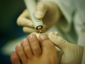 Close-up of a person's foot receiving toenail care