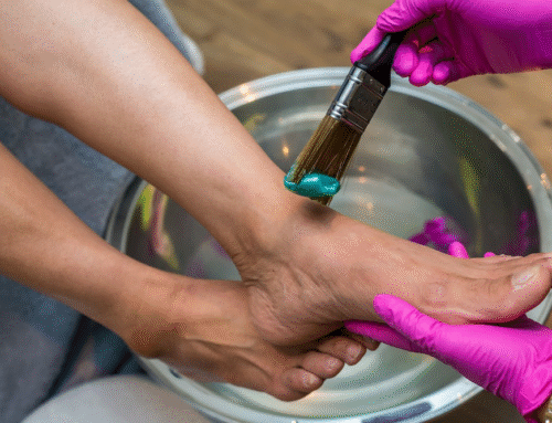 Toenail Fungus and Pedicures in Beverly Hills