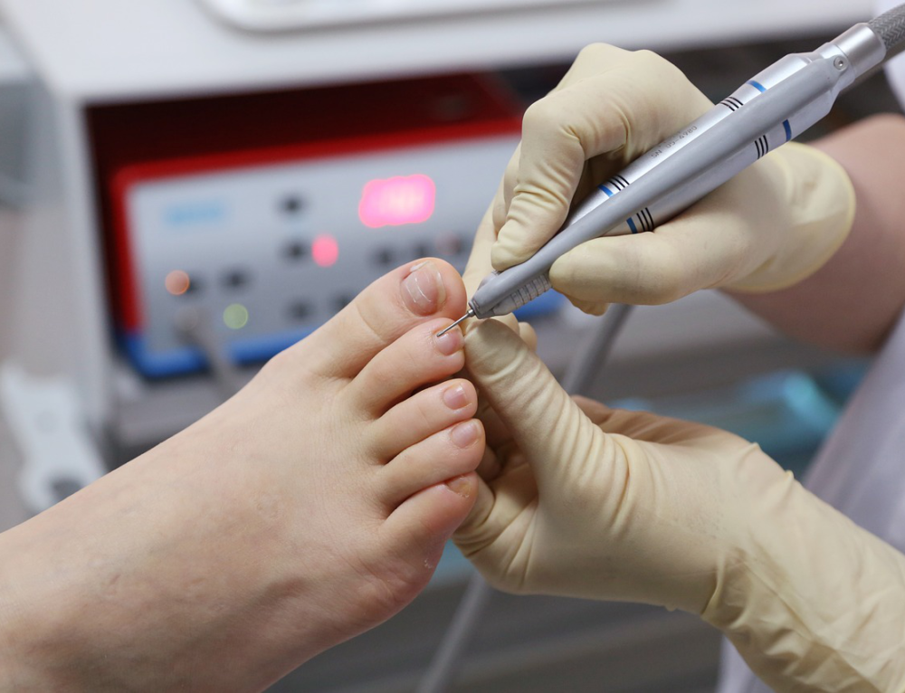 How To Soften Thick Toenails Toenail fungus Treatment Center