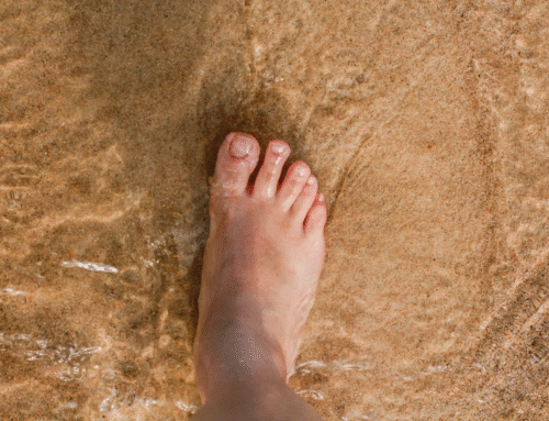 Toenail Fungus Treatment in Sunrise, FL