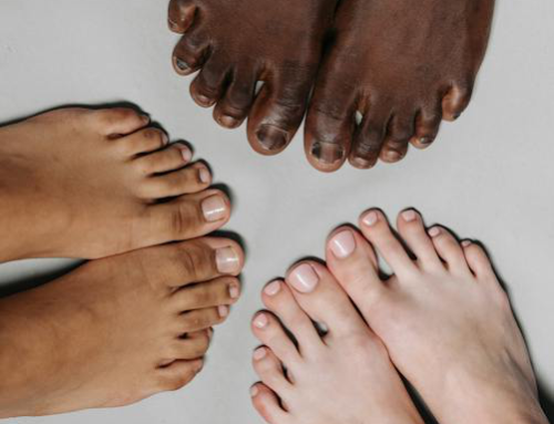 Addressing FAQs About Toenail Fungus Laser Therapy
